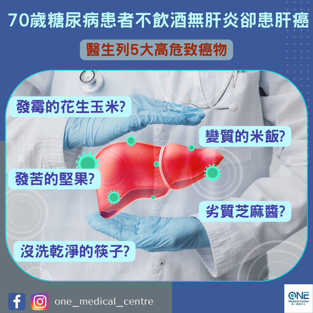 【癌症殺手 – 70歲糖尿病患者不飲酒無肝炎卻患肝癌　醫生列5大高危致癌物】